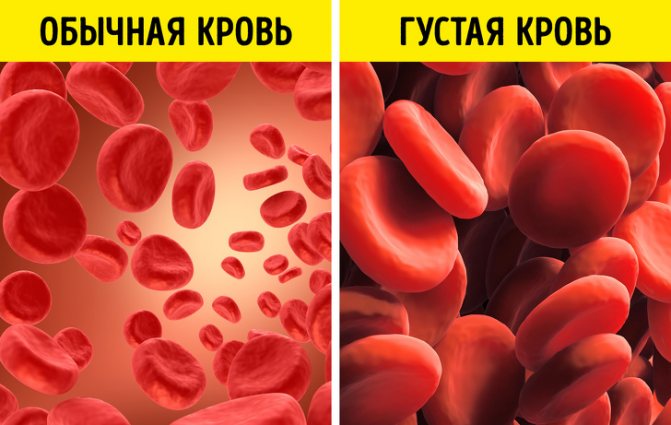 Свертываемость крови